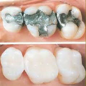 White-Fillings-home